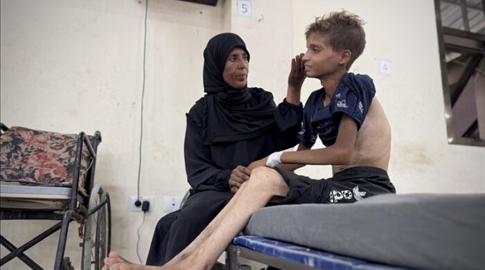 গাজায় ১৫ হাজার রোগীর জরুরি চিকিৎসা প্রয়োজন: ডব্লিউএইচও প্রধান